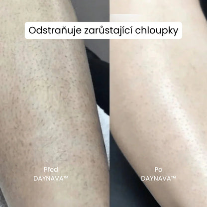 Daynava™ 5v1 Elektrický Holicí Strojek