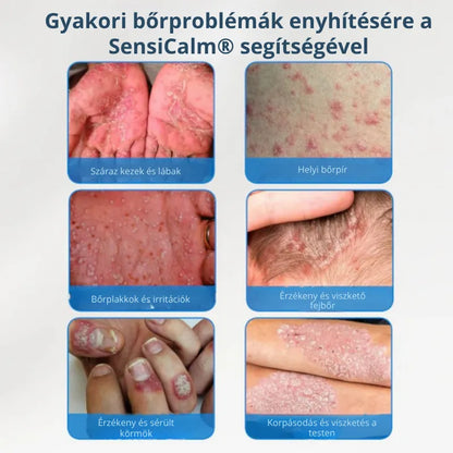 Nyugtató krém fejbőrre és bőrre HU