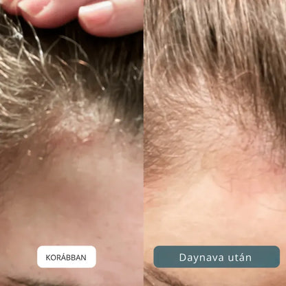 Nyugtató krém fejbőrre és bőrre HU