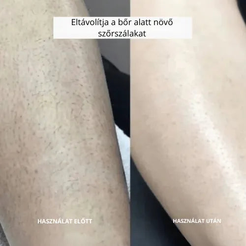 Daynava™ 5 az 1-ben Elektromos Borotva (HU)