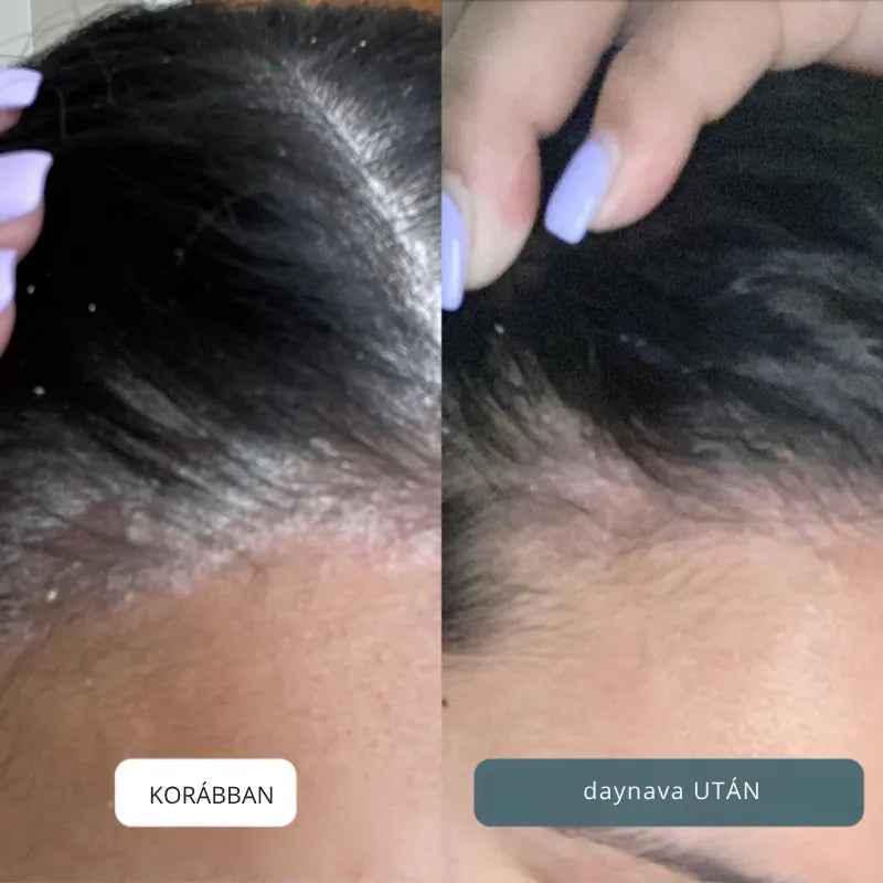 Nyugtató krém fejbőrre és bőrre HU