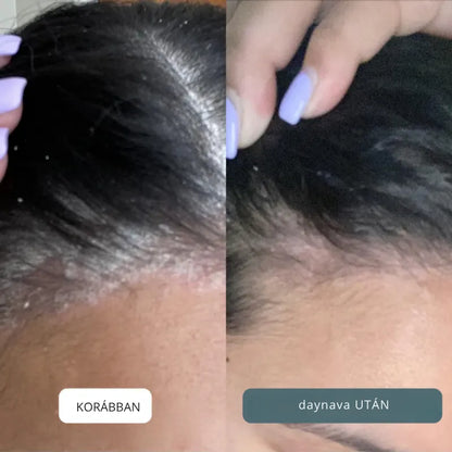 Nyugtató krém fejbőrre és bőrre HU