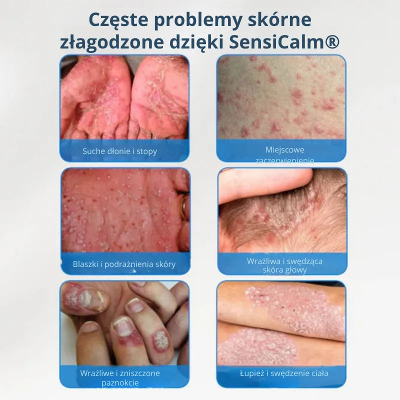Kojący krem do skóry głowy i skóry PL