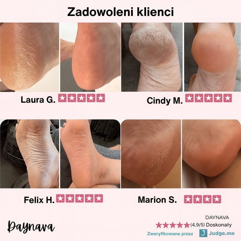 Elektryczny Pilnik do Stóp Daynava