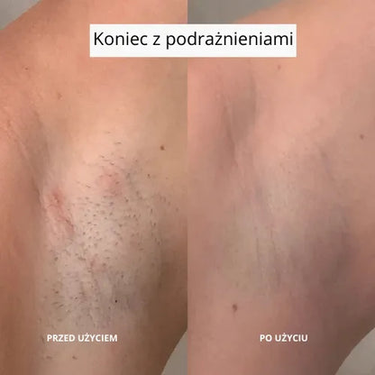 Daynava™ 5 w 1 Elektryczna Maszynka do Golenia (PL)