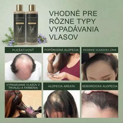 Šampón s Keratínom a Rozmarínom