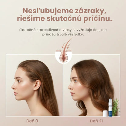 Daynava™ Roll-On na rast vlasov