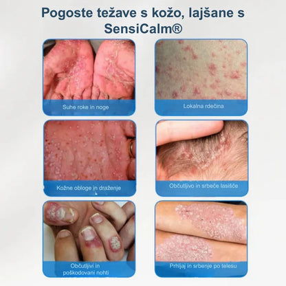 Pomirjujoča krema za lasišče in kožo SN